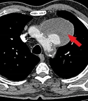Int J Cardiovasc Pract