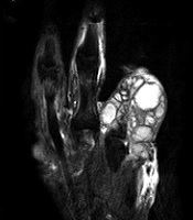 Iranian Journal of Radiology