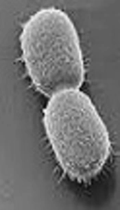 Distribution and Expression of Efflux Pump Gene and Antibiotic Resistance in <i>Acinetobacter baumannii</i>