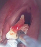 International Journal of Cancer Management