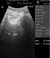 Middle East J Rehabil Health Stud