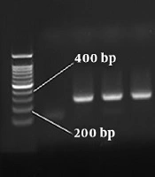 Jundishapur Journal of Microbiology 
