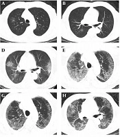 Iranian Journal of Radiology