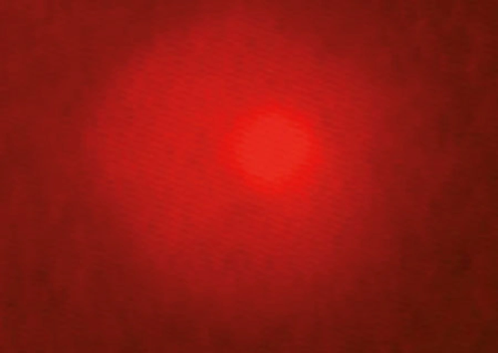 Microscopic Photograph 2 score 1 Microscopic Photograph 2 score 1