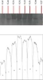 The Effect of Swimming Training with Curcumin Consumption on Superoxide Dismutase and Glutathione Peroxidase Levels in Alcoholic Rats’ Heart Tissue