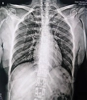 Modern Care J