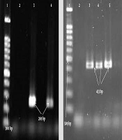 Jundishapur J Microbiol