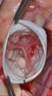 https://www.google.com/search?biw=1366&bih=626&tbm=isch&sa=1&ei=ZE6nW6f9HK3RrgS-t6_gAw&q=Aorta&oq=Aorta&gs_l=img.3..0l10.27554.27554.0.28535.1.1.0.0.0.0.437.437.4-1.1.0....0...1c.1.64.img..0.1.436....0.YV_im59L7SY#imgdii=YvARxI81mWlkaM:&imgrc=B5bP6TRV_vYD3M: