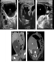 Iranian Journal of Radiology