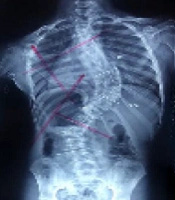 Arch Neurosc
