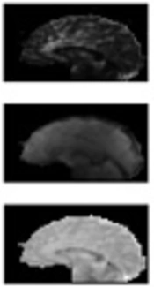 Quantitative Measurement of Oxygen Extraction Fraction (OEF) Using Respiratory Modulated Perfusion MRI