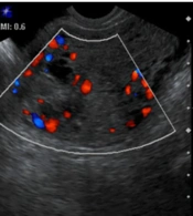  Iranian Journal of Radiology