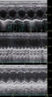 The Effects of Exercise Training Intensity on the Expression of C/EBPβ and CITED4 in Rats with Myocardial Infarction