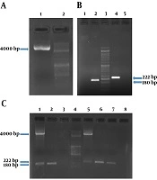 Jundishapur Journal of Microbiology