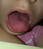 Journal of Comprehensive Pediatrics