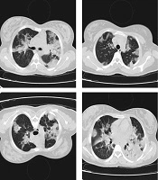Archives of Clinical Infectious Diseases