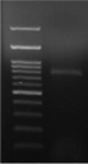 Detection of Metallo-Beta-Lactamase-Encoding Genes Among Clinical Isolates of <i>Pseudomonas aeruginosa</i> in Qom Province