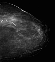 Iranian Journal of Radiology