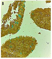 Gene Cell Tissue