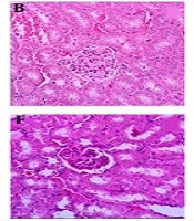 Jundishapur Journal of Natural Pharmaceutical Products