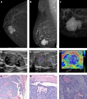 Iranian Journal of Radiology