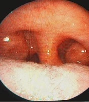 Multidisciplinary Cardiovascular Annals 