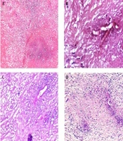 Arch Pediatr Infect Dis