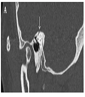 Iranian Journal of Radiology