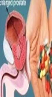 Benign Prostate Hyperplasia, Articles For Website