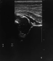 Iranian Journal of Radiology