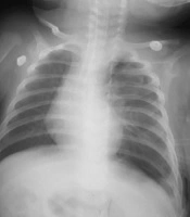 Journal of Comprehensive Pediatrics 