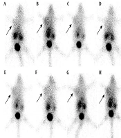 Iranian Journal of Radiology
