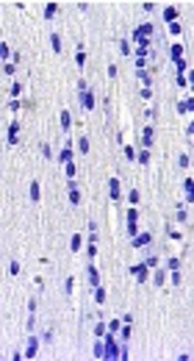 <i>Withania coagulans</i> Protects Striatum from Oxidative Damages Induced by Global Brain Ischemia in Rat