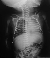 Archives of Pediatric Infectious Diseases 