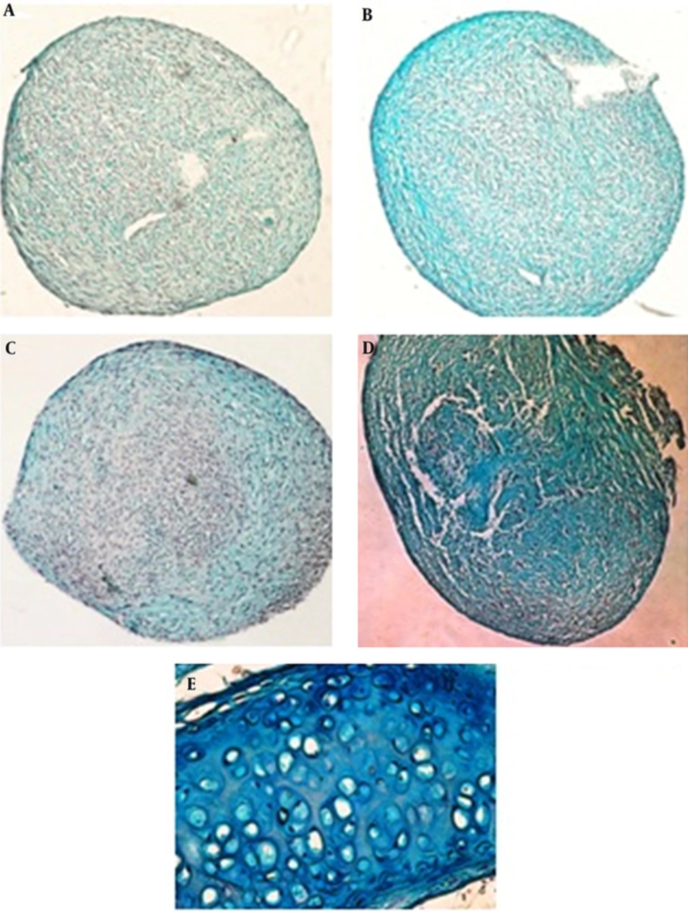 Micrographs of Alcian Blue Staining for Proteoglycans Production by ASCs After 14 Days of Culture and Hyaline Cartilage A, Control cultures; B, cultures treated with low-intensity ultrasound; C, TGF-β treated pellets; D, low-intensity ultrasound in combination with TGF-β; E, hyaline cartilage as a positive control.