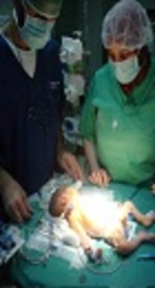 Utilization of Extracorporeal Membrane  Oxygenation In Pediatric
          Cardiac Surgery: A Single Center Experience, 34 Cases in 8 Years