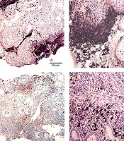 Hepatitis Monthly