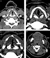 Iranian Journal of Radiology