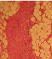 Jundishapur Journal of Natural Pharmaceutical Products