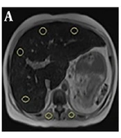 Iranian Journal of Radiology 