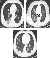 Iranian Journal of Radiology