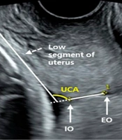 J Nurs Midwifery Sci