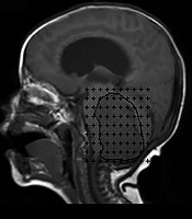 Iranian Journal of Radiology