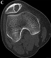 Iranian Journal of Radiology