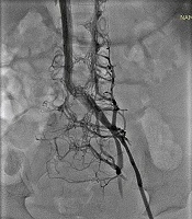 Iranian Journal of Pediatrics 