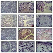 J Kermanshah Univ Med Sci 