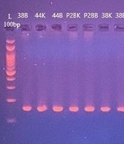 Jundishapur J Microbiol