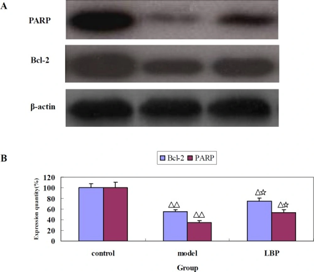 The effect of LBP on the expression of Bcl-2 and PARP in mice striatum. (A) Representative images of Bcl-2 and PARP protein expression detected by western blot. β-actin was used as a control. (B) Quantification of the Bcl-2 and PARP expression. Data are expressed as mean ± SD. from 3 independent experiments. Compared with control, <sup>Δ</sup><i>P </i>< 0.05, <sup>ΔΔ</sup><i>P </i>< 0.01; Compared with model
