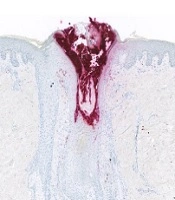 Journal of Skin and Stem Cell 