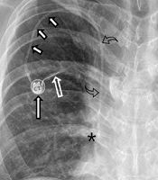 Iranian Journal of Radiology 